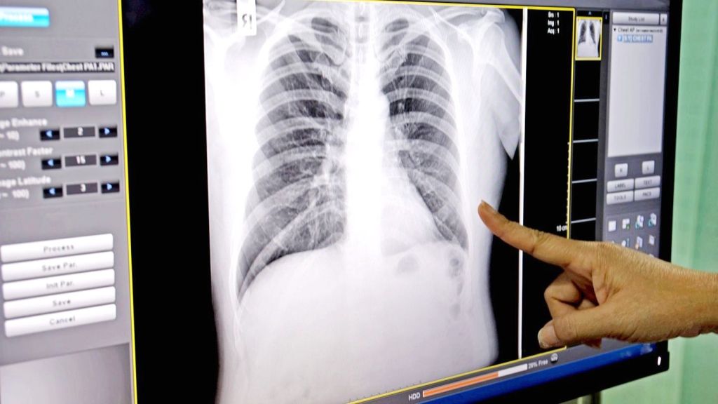 The Digital Radiography Revolution: Transforming Healthcare Imaging